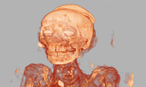 Volume Rendering