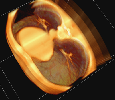 Look inside lungs