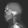 X-ray render mode and blending